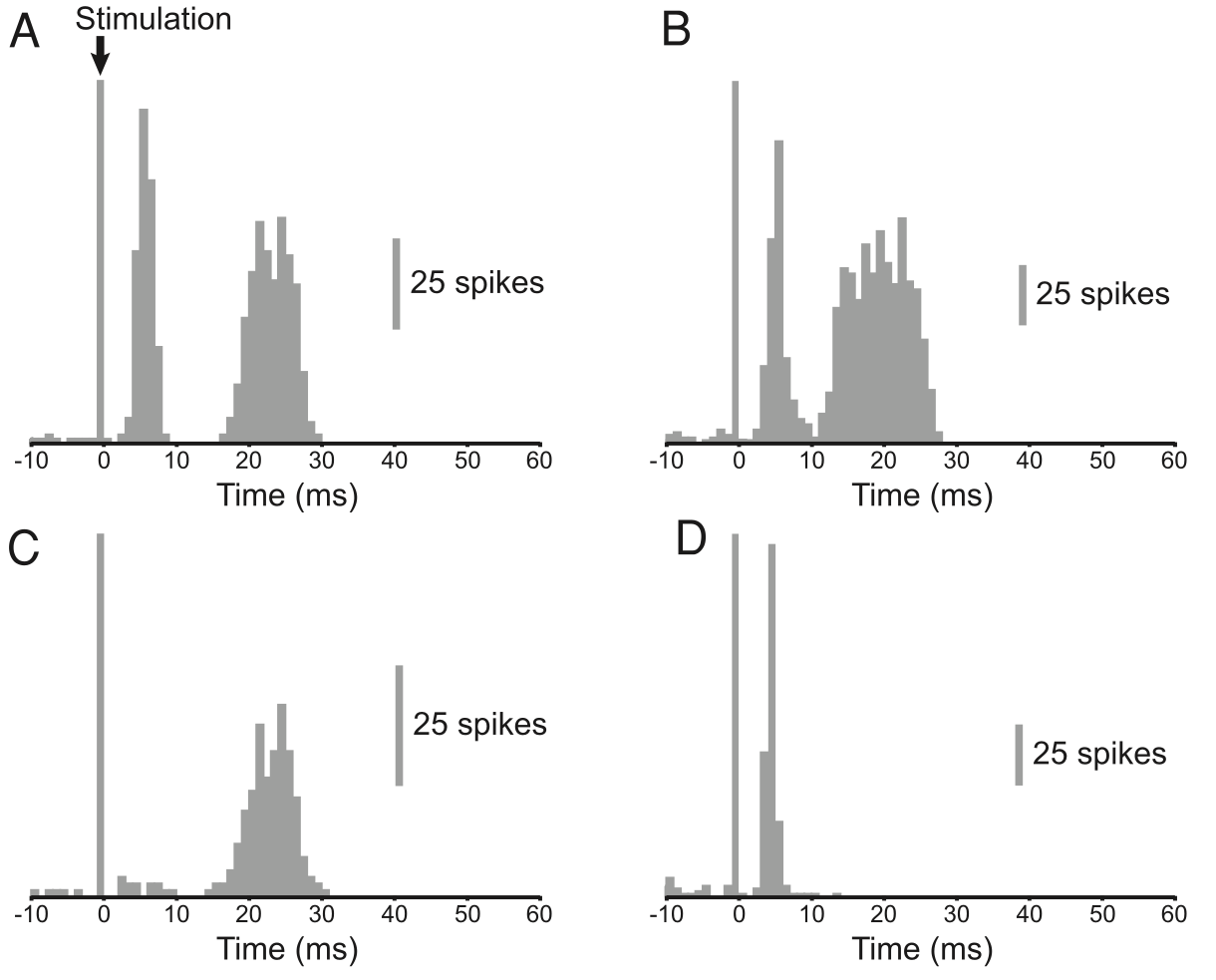 Neural recordings from STN neurons, with different response profiles, with panels A and B showing two initial bursts of activity followed by a long period of inhibition, which then recovers. The recovery window is not specifically shown but is described in the paper. From Magill et al., 2004