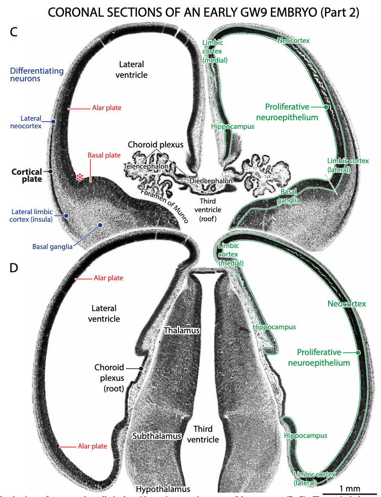 The mesocortical ring structure in a human embryo at gestational week 9. From Altman & Bayer (2015).