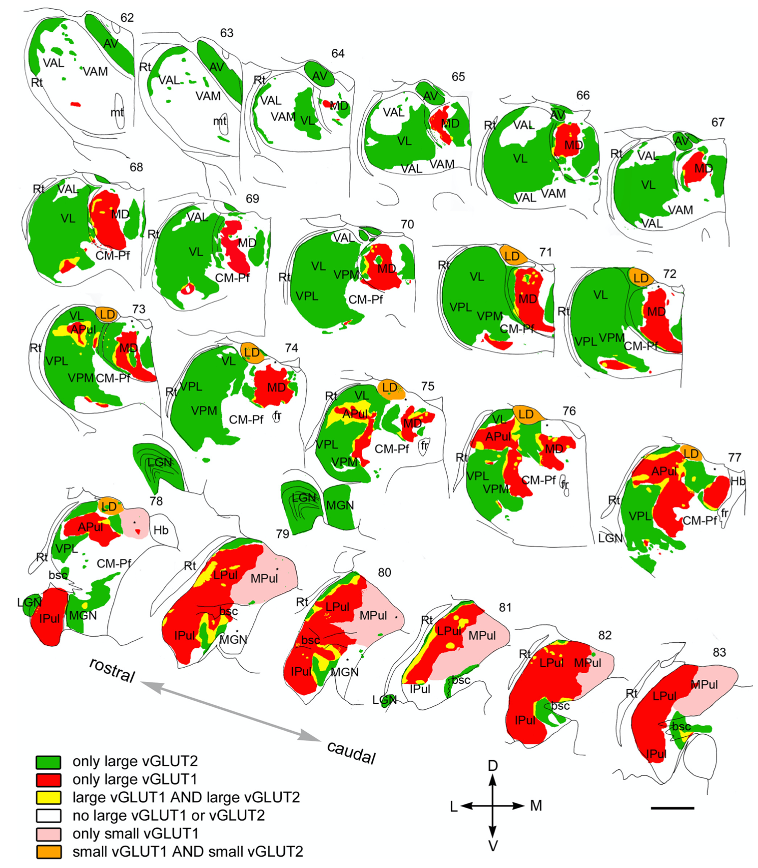 Different types of thalamic drivers in the primate thalamus, which provides key insight into functions of these thalamic areas and the cortical areas they interconnected with. Large = strong, small = weak. vGLUT2 = subcortical drivers, e.g., green are all primary sensory (LGN = vision, MGN = auditory, VPM, VPL = somatosensory) and motor (VL = cerebellum); vGLUT1 = cortical drivers (red). Inhibitory driver inputs, as from the basal ganglia output areas (SNr, GPi, VP), show up as blank (white) (e.g., the VAL, VAM, VAL frontal thalamic areas), and the MD actually has a mix of neurons with these inhibitory drivers and pulvinar-like cortical drivers, but only the pulvinar-like aspect is represented as indicated by its red color, except the medial MDm which has more uniform inhibitory input from VP (ventral pallidum). From Rovo et al., 2012.