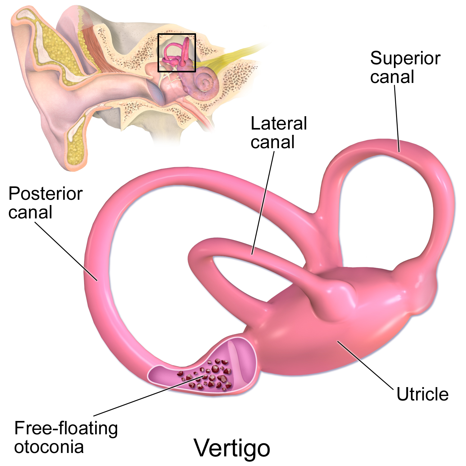 The vestibular organ that transduces rotational and linear motion signals into neural firing signals. The semicircular canals are sensitive to rotational motion on 3 different axes, while the otolith organs are sensitive to linear motion. Figure from BruceBlaus on Wikimedia Commons (CC-SA-4.0).