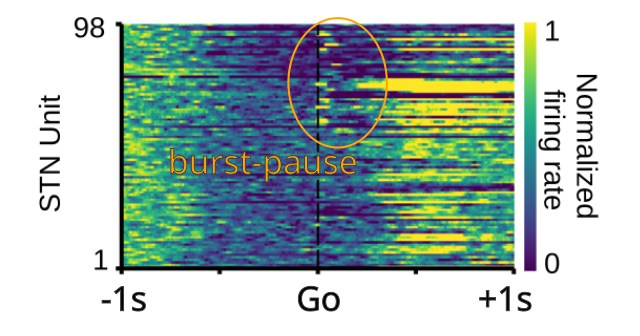 Neural recordings from STN neurons, with several neurons showing the triphasic burst-then-pause activity pattern, while others do not, consistent with a heterogenous population of neuron types. These neurons exhibited a negatively ramping activity level prior to the Go cue – others that exhibited a positive ramp did not show the burst-pause activity. From Mirzaei et al., 2017