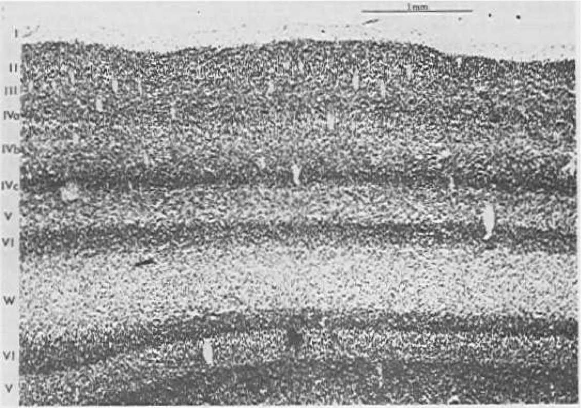 A slice of the visual cortex of a cat, showing the six major cortical layers (I - VI), with sublayers of layer IV that are only present in visual cortex. The first layer (I) is primarily axons (“white matter”). Reproduced from Sejnowski and Churchland (1989).
